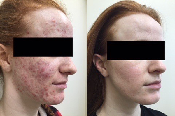 before-after-image
