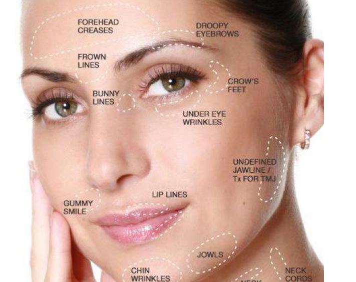 botox-and-fillers-new11