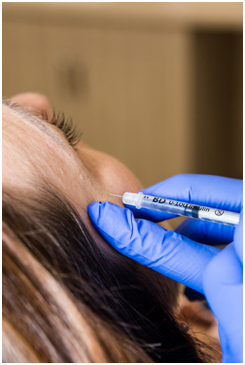 botox-and-fillers2