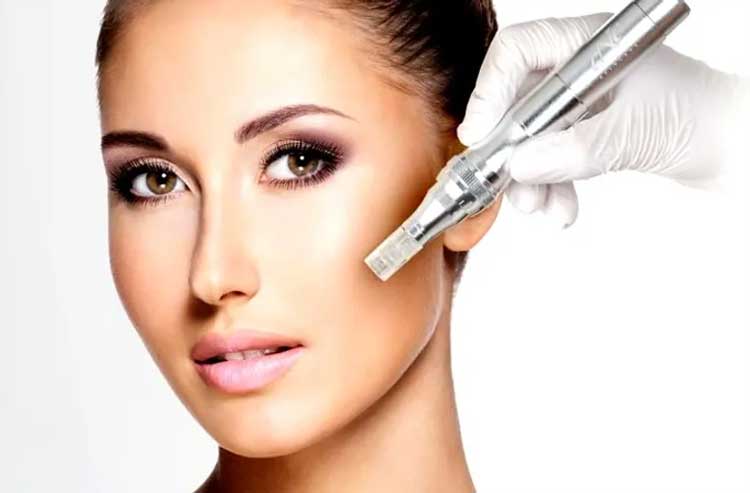 ciin30101903-01-Microneedling