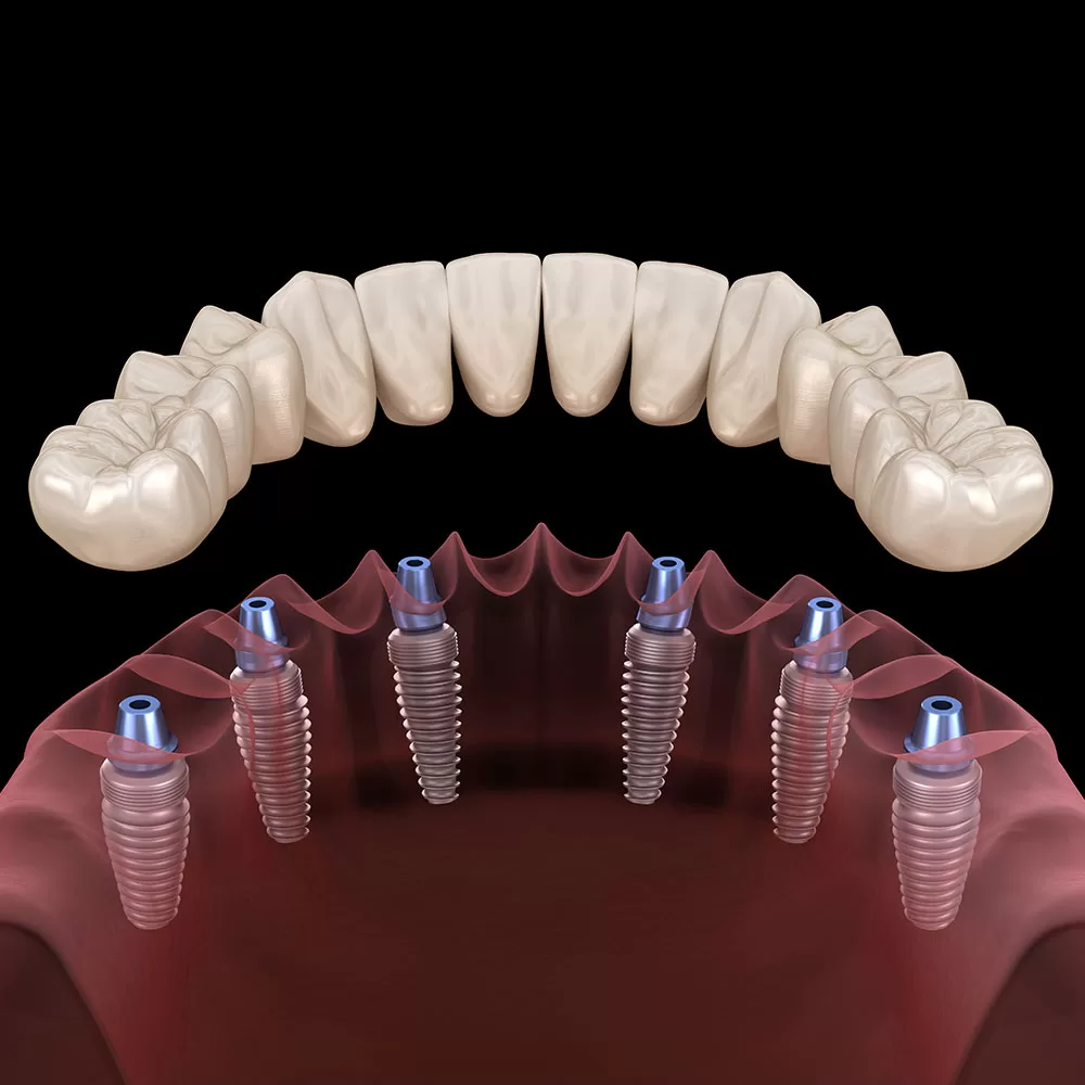 dentures-blackbg