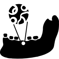 jawbone