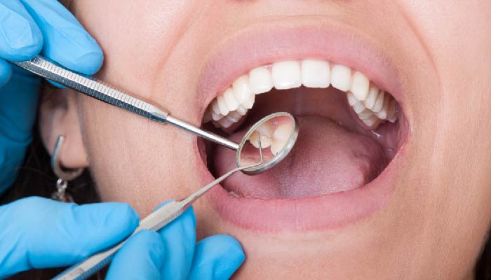 Root-Canal-vs.-Pulling-the-Tooth